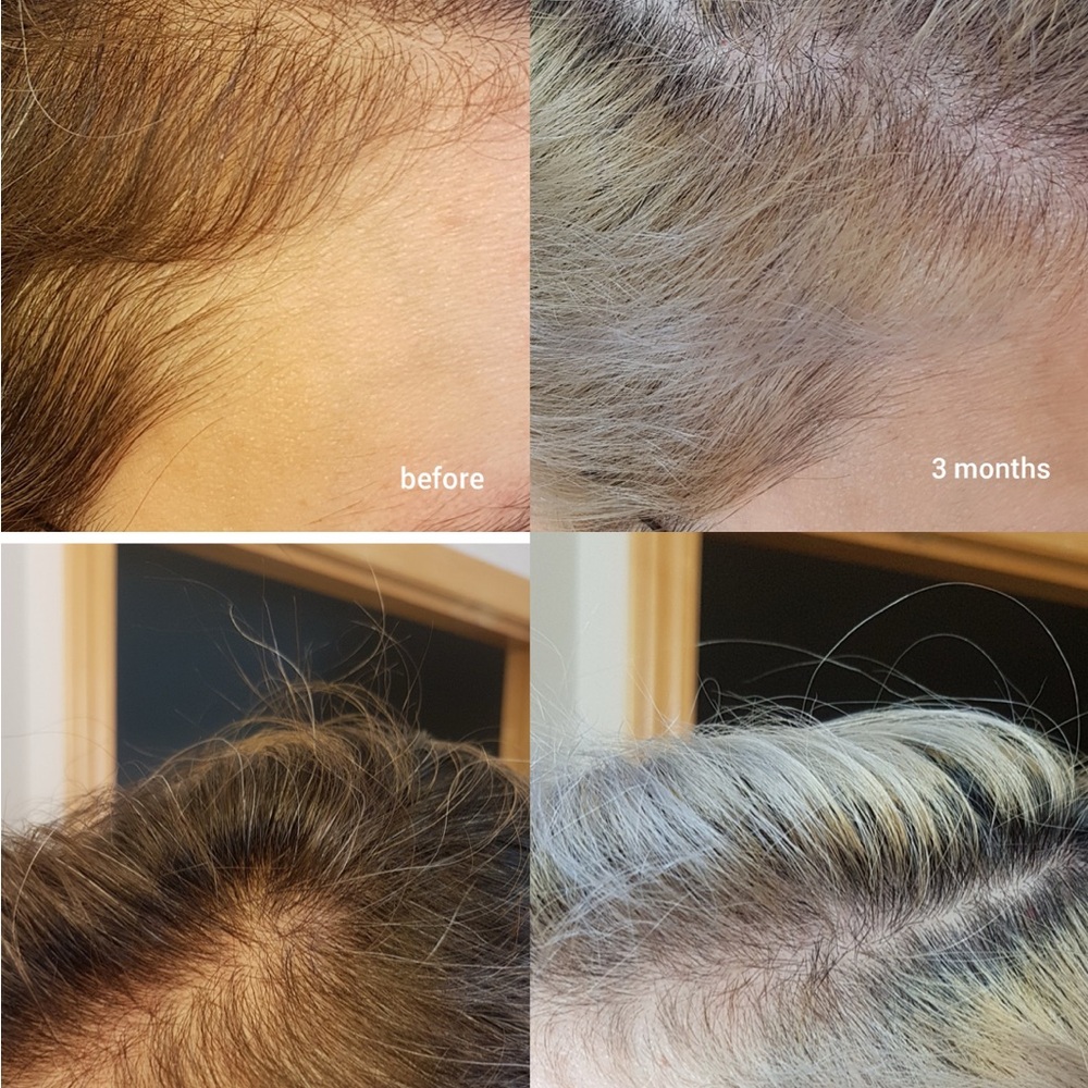 The Ordinary Multi-Peptide Serum for Hair Density - Brown - Picture 4 of 9
